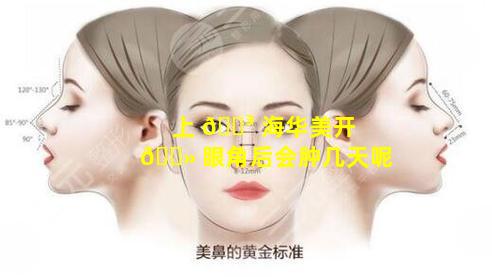 上 🐳 海华美开 🌻 眼角后会肿几天呢